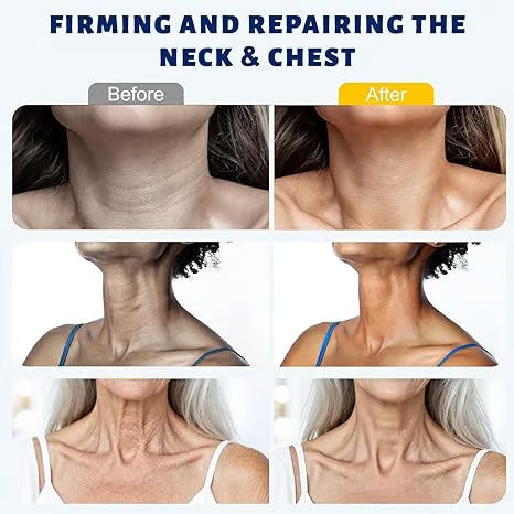 Reduces Wrinkles and Double Chin,Five Rollers for All Around Massage,Neck Firming Cream