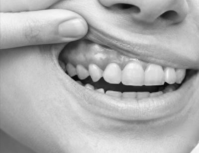 😍 Limited Offer 🔥40% OFF | Hydroxyapatite Toothpaste