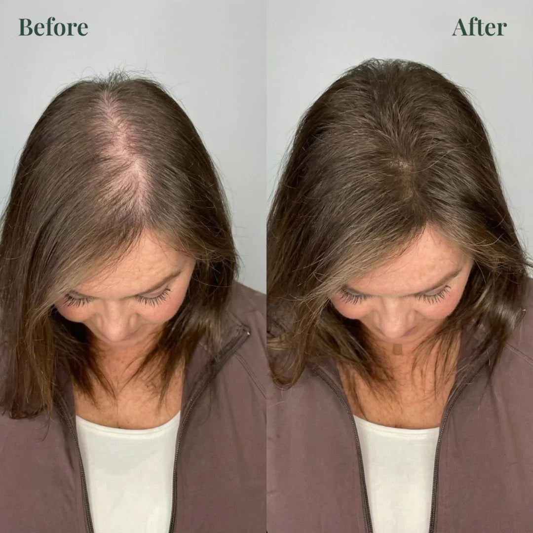Kerarose Rosemary Shampoo For Hair Growth (Buy 1 Get 1 Free 🔥🔥)